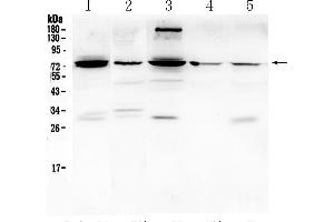 Western Blotting (WB) image for anti-Prostaglandin-Endoperoxide Synthase 2 (Prostaglandin G/H Synthase and Cyclooxygenase) (PTGS2) (AA 365-397), (Middle Region) antibody (ABIN5518867)