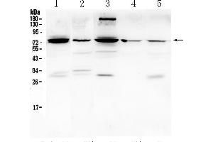 Western blot analysis of PTGS2 using anti- PTGS2 antibody . (PTGS2 antibody  (Middle Region))