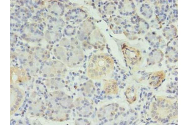 RFX6 antibody  (AA 1-260)