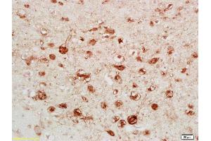 Formalin-fixed and paraffin embedded rat brain labeled with Anti-Calretinin/CA Polyclonal Antibody, Unconjugated (ABIN724355) followed by conjugation to the secondary antibody and DAB staining (Calretinin antibody  (AA 211-271))