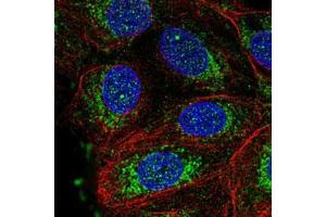 Immunofluorescent staining of MCF7 cells with NDUFS3 polyclonal antibody  (Green) shows positivity in nucleus and mitochondria. (NDUFS3 antibody)