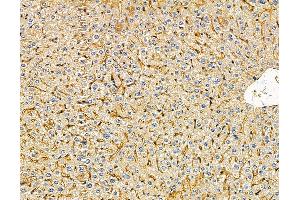 ABIN7096030 and ABIN7100092 at 1/100 staining mouse liver tissue by IHC-P. (MFSD6 antibody)