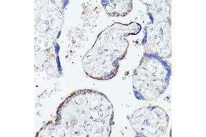 Immunohistochemistry of paraffin-embedded human placenta using HSPB11 antibody (ABIN7267591) at dilution of 1:100 (40x lens). (HSPB11 antibody)