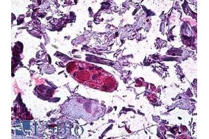 Immunohistochemistry (IHC) image for anti-Diacylglycerol O-Acyltransferase 1 (DGAT1) (Internal Region) antibody (ABIN190886)