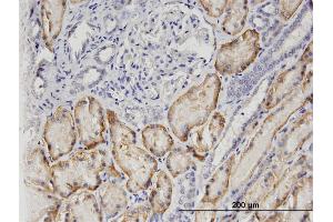 Immunoperoxidase of monoclonal antibody to SLC22A6 on formalin-fixed paraffin-embedded human kidney. (SLC22A6 antibody  (AA 451-550))