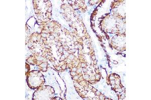 Immunohistochemistry of paraffin-embedded mouse kidney using NDRG1 Rabbit mAb (ABIN7268783) at dilution of 1:100 (40x lens). (NDRG1 antibody)