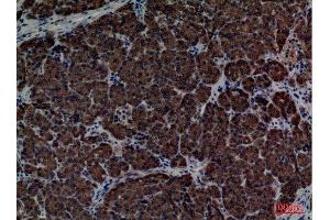 Immunohistochemistry (IHC) image for anti-CD1e (CD1e) (C-Term) antibody (ABIN3187771)