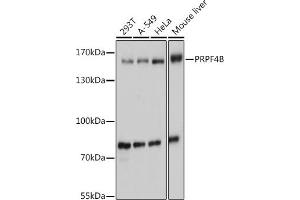 PRPF4B antibody  (AA 550-760)