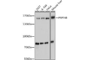 Western blot analysis of extracts of various cell lines, using PRPF4B antibody (ABIN7270232) at 1:1000 dilution. (PRPF4B antibody  (AA 550-760))