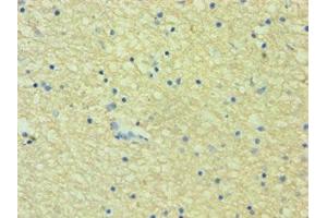 Immunohistochemistry of paraffin-embedded human brain tissue using ABIN7142626 at dilution of 1:100
