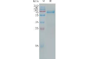 Leukocyte Immunoglobulin-Like Receptor, Subfamily B (With TM and ITIM Domains), Member 4 (LILRB4) (AA 22-259) protein (Fc Tag)