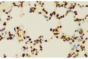 Immunohistochemistry of paraffin-embedded Mouse lung using DiMethyl-Histone H3-K4 Polyclonal Antibody at dilution of 1:100 (40x lens). (Histone 3 antibody  (2meLys4))