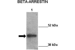 Sample Type :  Lane 1: 20ug mouse left ventricle heart lysate  Primary Antibody Dilution :   1:1000  Secondary Antibody:  Anti-rabbit-HRP  Secondary Antibody Dilution:   1:5000  Color/Signal Descriptions:  ARRB2  Gene Name:  Kathleen Gabrielson  Submitted by: (Arrestin 3 antibody  (Middle Region))