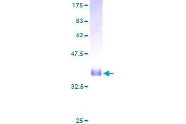 SPRR1B Protein (AA 1-89) (GST tag)