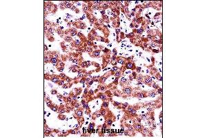 ITGB5 Antibody (N-term) (ABIN657921 and ABIN2846868) immunohistochemistry analysis in formalin fixed and paraffin embedded human liver tissue followed by peroxidase conjugation of the secondary antibody and DAB staining. (Integrin beta 5 antibody  (N-Term))