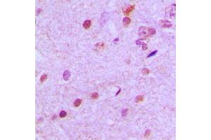 Immunohistochemical analysis of NEUROD2 staining in human brain formalin fixed paraffin embedded tissue section. (NEUROD2 antibody  (Center))
