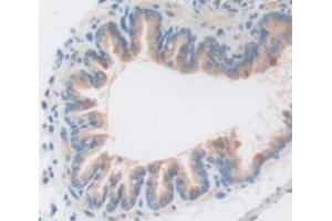 Figure. (Caspase 1 antibody  (AA 119-296))