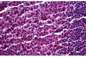 Human Tonsil: Formalin-Fixed, Paraffin-Embedded (FFPE) (SP140 antibody  (AA 504-613))
