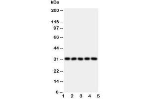 Western blot testing of LOX-1 antibody and Lane 1:  HeLa;  2: SMMC-7721;  3: U87;  4: U937;  5: K562 lysate.