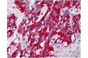 Image no. 1 for anti-Deleted in Liver Cancer 1 (DLC1) (Isoform 1), (Isoform 3), (N-Term) antibody (ABIN452680)