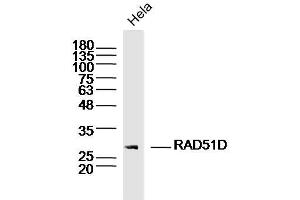 Hela lysates probed with RAD51D Polyclonal Antibody, Unconjugated  at 1:300 dilution and 4˚C overnight incubation. (RAD51D antibody  (AA 1-100))