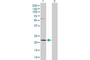 Western Blot analysis of CSN3 expression in transfected 293T cell line by CSN3 MaxPab polyclonal antibody. (CSN3 antibody  (AA 1-182))