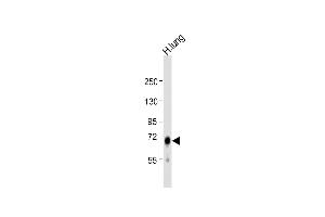 Anti-IDUA Antibody (Center) at 1:1000 dilution + human lung lysate Lysates/proteins at 20 μg per lane. (IDUA antibody  (AA 236-264))