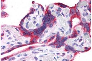 Human Placenta: Formalin-Fixed, Paraffin-Embedded (FFPE) (Leptin antibody  (N-Term))