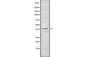 Western blot analysis of CDC123 using COLO205 whole cell lysates