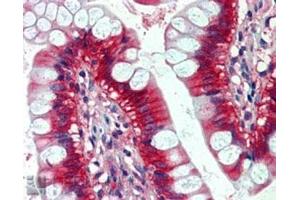 IHC staining of FFPE human small intestine with NRAS antibody at 2. (GTPase NRas antibody)