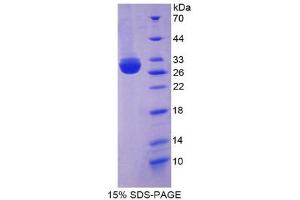 SDS-PAGE (SDS) image for Membrane Protein, Palmitoylated 5 (AA 455-675) protein (His tag) (ABIN2125838) (Membrane Protein, Palmitoylated 5 (AA 455-675) protein (His tag))