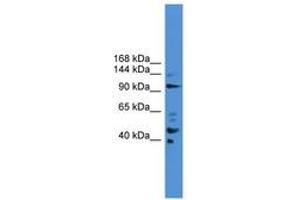Image no. 1 for anti-Progesterone Immunomodulatory Binding Factor 1 (PIBF1) (AA 601-650) antibody (ABIN6745470)
