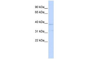WB Suggested Anti-KCNK15 Antibody Titration:  0. (KCNK15 antibody  (Middle Region))