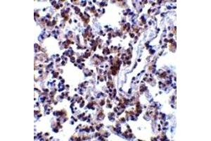 Immunohistochemistry (IHC) image for anti-B-Cell Receptor-Associated Protein 31 (BCAP31) (C-Term) antibody (ABIN1030283) (BCAP31 antibody  (C-Term))