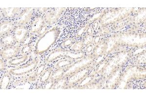 Detection of IL18 in Human Kidney Tissue using Monoclonal Antibody to Interleukin 18 (IL18) (IL-18 antibody  (AA 94-193))