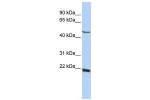 Western Blotting (WB) image for anti-Synovial Sarcoma, X Breakpoint 4 (SSX4) antibody (ABIN2458169) (SSX4 antibody)