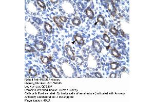 Human kidney (RGS6 antibody  (C-Term))