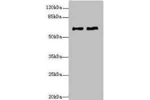 Western blot All lanes: COL9A3antibody at 1. (COL9A3 antibody  (AA 445-684))