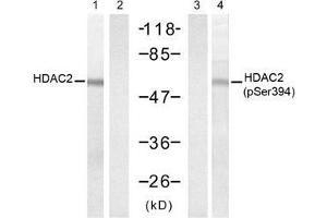 Western blot analysis of extracts from HT-29 cells untreated or treated with UV (20min), using HDAC2 (Ab-394) antibody (E021140, Lane 1 and 2) and HDAC2 (Phospho-Ser394) antibody (E011191, Lane 3 and 4). (HDAC2 antibody  (pSer394))