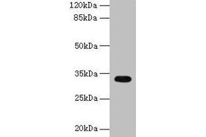 Western blot All lanes: CYB5R2 antibody at 4 μg/mL + Mouse kidney tissue Secondary Goat polyclonal to rabbit IgG at 1/10000 dilution Predicted band size: 32, 28 kDa Observed band size: 32 kDa (CYB5R2 antibody  (AA 1-237))