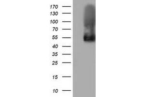 HEK293T cells were transfected with the pCMV6-ENTRY control (Left lane) or pCMV6-ENTRY BTN1A1 (Right lane) cDNA for 48 hrs and lysed. (BTN1A1 antibody)