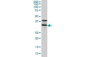 STX5A monoclonal antibody (M01), clone 5A6 Western Blot analysis of STX5A expression in A-431