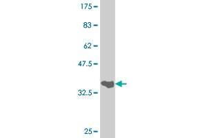 Western Blot detection against Immunogen (34. (FOXA1 antibody  (AA 287-370))