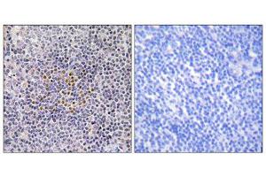 Immunohistochemistry analysis of paraffin-embedded human tonsil tissue using XRCC3 antibody. (XRCC3 antibody  (Internal Region))
