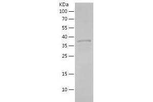 Western Blotting (WB) image for Myocyte Enhancer Factor 2C (MEF2C) (AA 350-473) protein (His-IF2DI Tag) (ABIN7124046) (MEF2C Protein (AA 350-473) (His-IF2DI Tag))