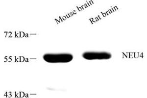 Western blot analysis of NEU4 (ABIN7075594) at dilution of 1: 1000