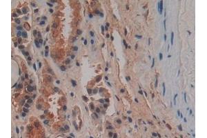 Detection of OPN in Human Kidney Tissue using Polyclonal Antibody to Osteopontin (OPN) (Osteopontin antibody  (AA 17-287))