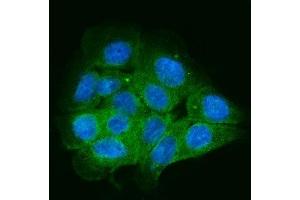 IF analysis of ENAH/MENA using anti-ENAH/MENA antibody (ABIN7601316). (ENAH antibody  (AA 32-551))