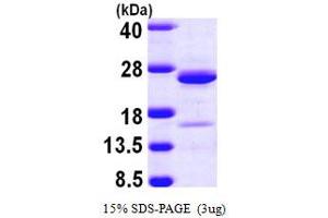 SDS-PAGE (SDS) image for Neurocalcin delta (NCALD) (AA 1-193) protein (His tag) (ABIN666638) (NCALD Protein (AA 1-193) (His tag))