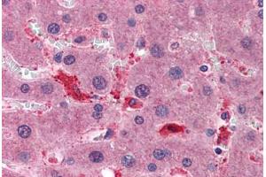 Human Liver: Formalin-Fixed, Paraffin-Embedded (FFPE) (Superoxide dismutase copper chaperone antibody  (AA 175-275))